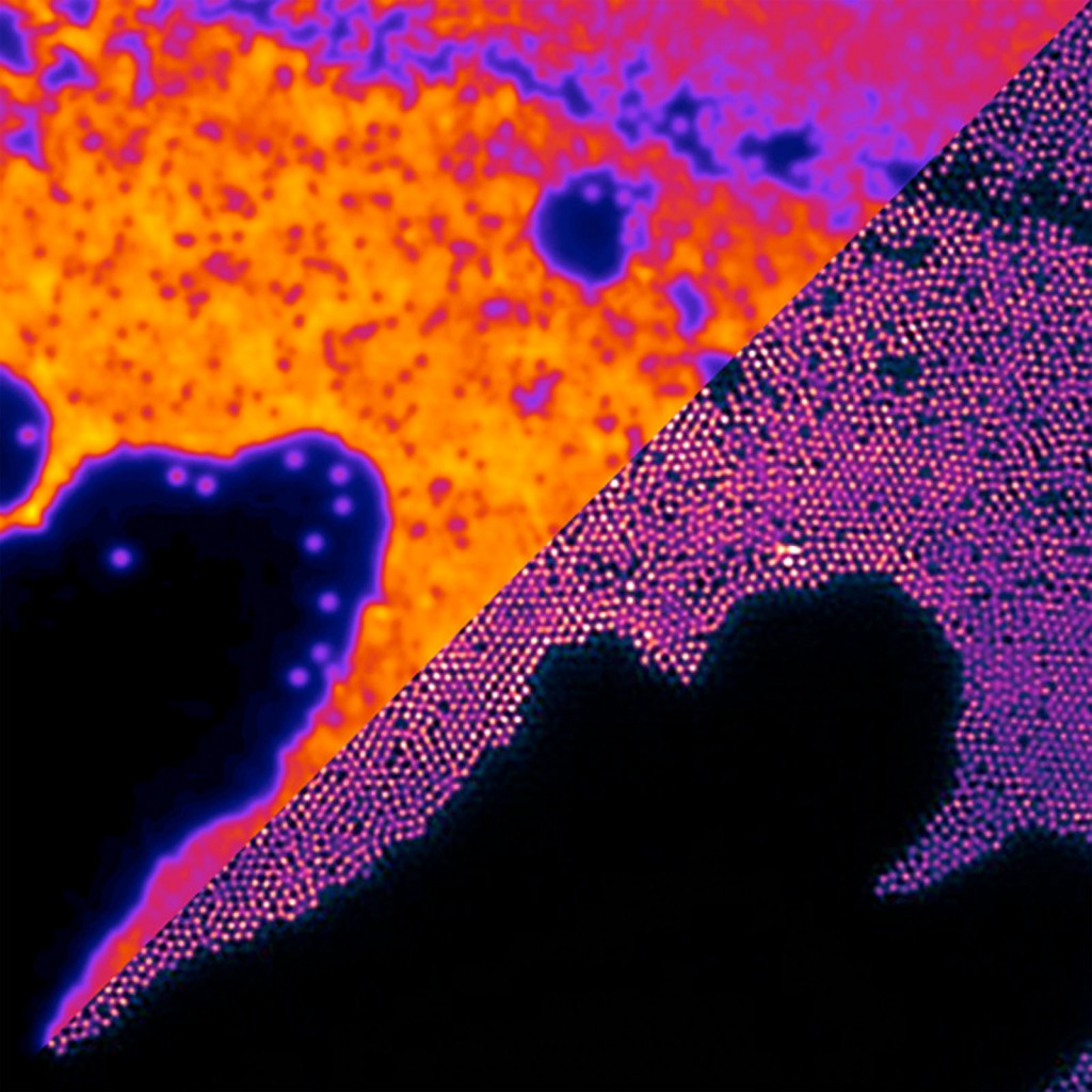 Super resolution microscope image